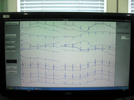 ekg_aparat_shmp_2